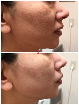 ホワイトセージ(White Sage)/ビフォーアフター3