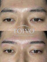 トイヴォ(TOIVO)/丁寧なカウンセリングで安心♪