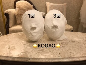 コガオ(KOGAO)/【効果実感】石膏パック×小顔