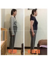 こおりやま整体院/体の回復には時間がかかります