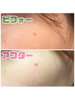 ドマーニプラス 岐阜シティタワー43店(DOMANI PLUS.)/年齢肌にはフォト美顔が効果的