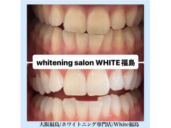 ホワイトニングサロン ホワイト(WHITE)/セルフホワイトニング/大阪/福島