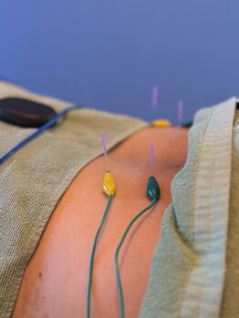 鍼灸整体院 はり処もりしーの森/☆電気の鍼(一部)