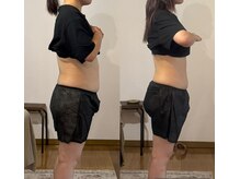 しあわせ腸研究所/before＆after