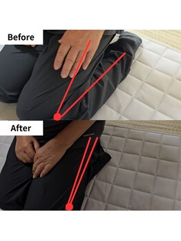 Re:ひざケア/ひざを触らず、背骨施術だけで！