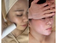 骨と筋肉に圧を加え血流アップ。クールウェーブでリフトアップ