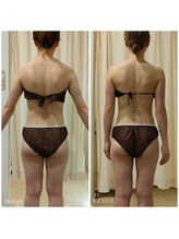 ルノン(Lunon)/《ブライダル》直角肩・鎖骨作り