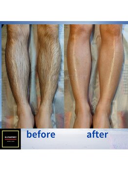 ビー ファクトリー(B FACTORY)/メンズ　脚ワックス