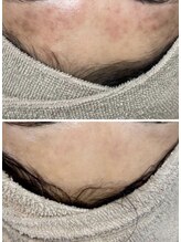 ロイヤル ビューティー サロン(Royal Beauty Saloon)/韓国発最新肌管理【セルマン】