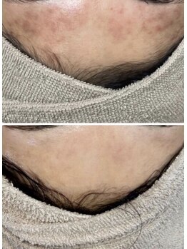 ロイヤル ビューティー サロン(Royal Beauty Saloon)/韓国発最新肌管理【セルマン】