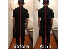 カワル整体 上通り院/腰痛で体幹を鍛える理由は？