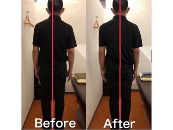 カワル整体 上通り院/腰痛で体幹を鍛える理由は?