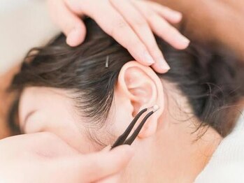 【痩身ダイエット・耳つぼ・毛穴洗浄】Total beauty Salon de SKeyの写真/【尾張旭】下半身太り・蓄積脂肪分解◎歴20年の耳つぼ×腸活食アドバイス☆我慢なしの短期集中ダイエット