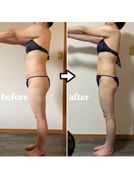 エレナ(Elena)/ヒートマット＋セルゼロ痩身