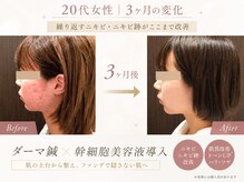はる鍼灸整骨院