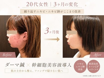 はる鍼灸整骨院の写真