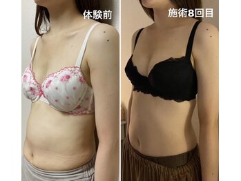 マホラ 本店(Mahora)/Before/After