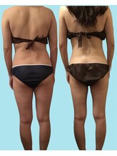 ビューティーワークス シャンティ 印西店(Beauty Works Shanti)/お客様ビフォーアフター(1)