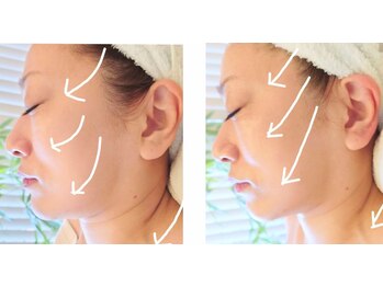 アステキ(ASUTEKI)/小顔１回ビフォー＆アフター！