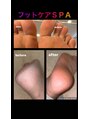 エンジェル ネイル(ANGEL NAIL)&nbsp;フットケアはスパに来た感覚の極上ケアをお楽しみ下さい！