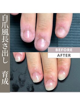 自爪風長さだしマット仕上げ