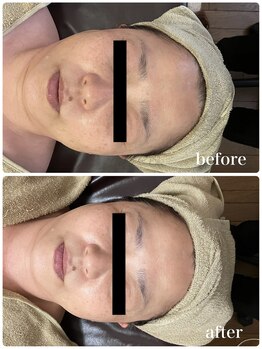 ジャスミン(Jasmin)/ホワイトニングフェイシャル