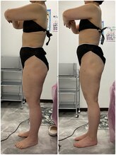 輝 らいと/ビフォーアフター（横）