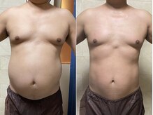 クイーン 熱海店(Queen)/内臓脂肪も○○を使うとホッソリ