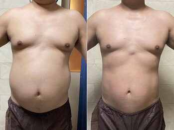 クイーン 熱海店(Queen)/内臓脂肪も○○を使うとホッソリ