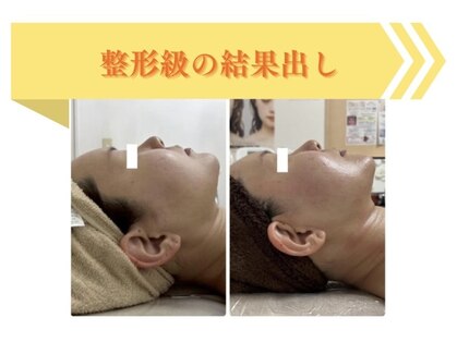 カレン(KAREN)の写真