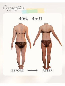 ジプソフィラ(Gypsophila)/痩身ビフォーアフター