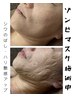 【期間限定メニュー◆】ゾンビマスクでシワのばし、引き締め☆50分8,000円