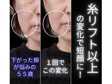 目元 口元のたるみ 眉間シワ改善専門サロンの雰囲気(筋膜を引上げて首の長さも復活♪当店だけの技術☆詳細はブログで)