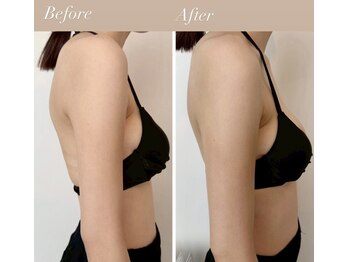 ハーバシー ラボ(herbacie LABO)/美バストセラピー