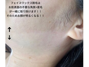 ピークハント(Peak Hunt)の写真/《フェイスワックスメニューあります! 》どの角度から見られてもツルンと美肌◇至近距離でも自信が持てる！