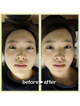 リボーン(Reboorn)/小顔になりたい/すっきりしたい