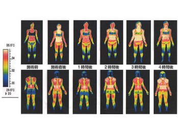 ソレイユ/インディバは痛みにも良い◎