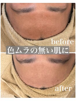 マルコ(marco)/エイジングケア