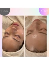 セゾン(Saison)/韓国人のような水光肌に！