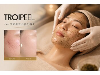 サロン ド セイ(Salon de SEI)の写真/［577万本分の美肌の種を植え肌をターンオーバー］トロイピール×筋膜リリース