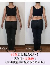 バストラボ 仙台店/年齢が出る後ろ姿に自信を持つ！