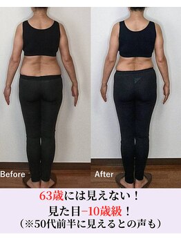バストラボ 仙台店/年齢が出る後ろ姿に自信を持つ！