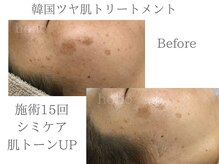 いごこちいい場所 ほのほの/シミケアも得意♪