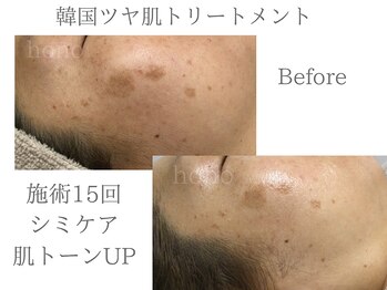 いごこちいい場所 ほのほの/シミケアも得意♪