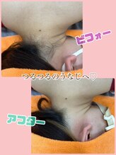 ドマーニプラス 岐阜シティタワー43店(DOMANI PLUS.)/えり足脱毛