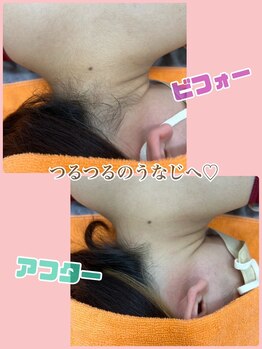 ドマーニプラス 岐阜シティタワー43店(DOMANI PLUS.)/えり足脱毛