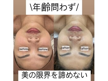 フローレンス(Florence)/韓国式肌管理