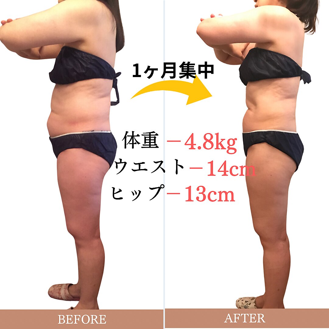 シェイプリフト　定価約30万　美容　痩身　ダイエット パルフェット(parfaite)｜ホットペッパービューティー
