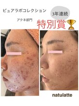 ナチュラルビューティラテ(NATURAL BEAUTY LATTE)/ピュアラボコレクション受賞