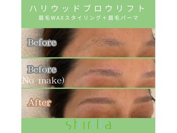 シンカ 湘南江ノ島 鵠沼(shinka)/【HBL】　Before/After 